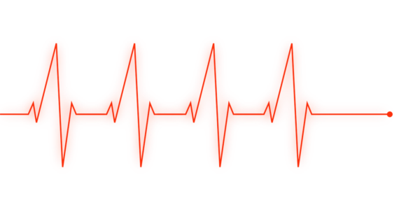 electro cardiogramme