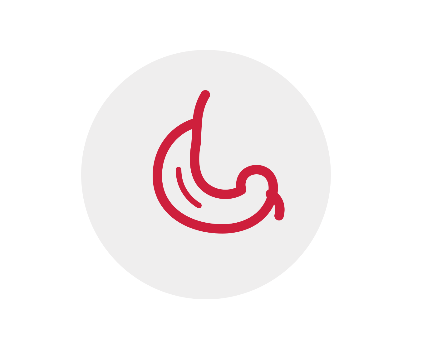 Illustration de la maladie de crohn, pour assurance de prêt 